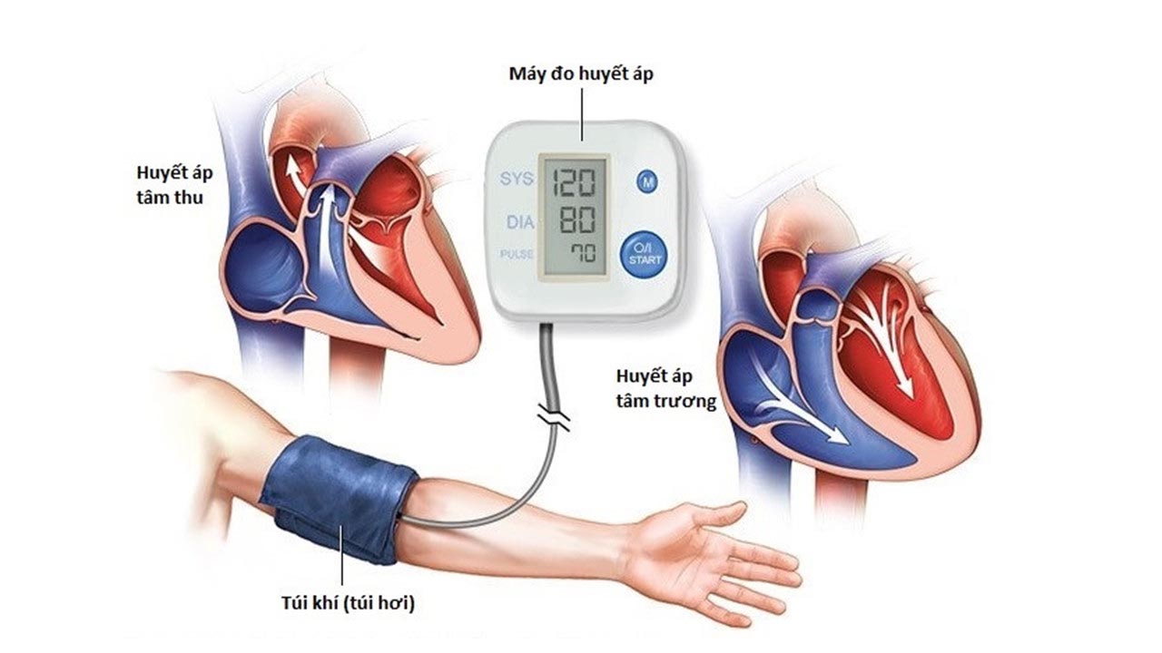 Các dấu hiệu của huyết áp tâm trương thấp